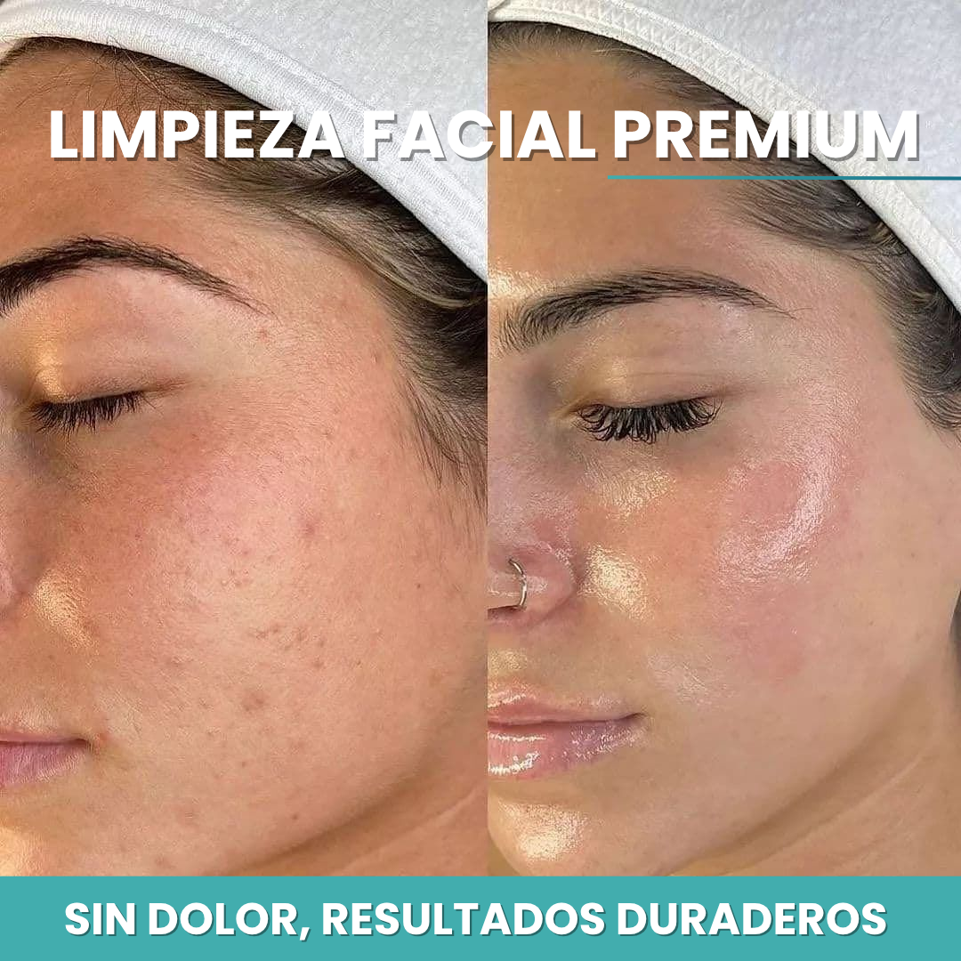 LIMPIEZA FACIAL PREMIUM