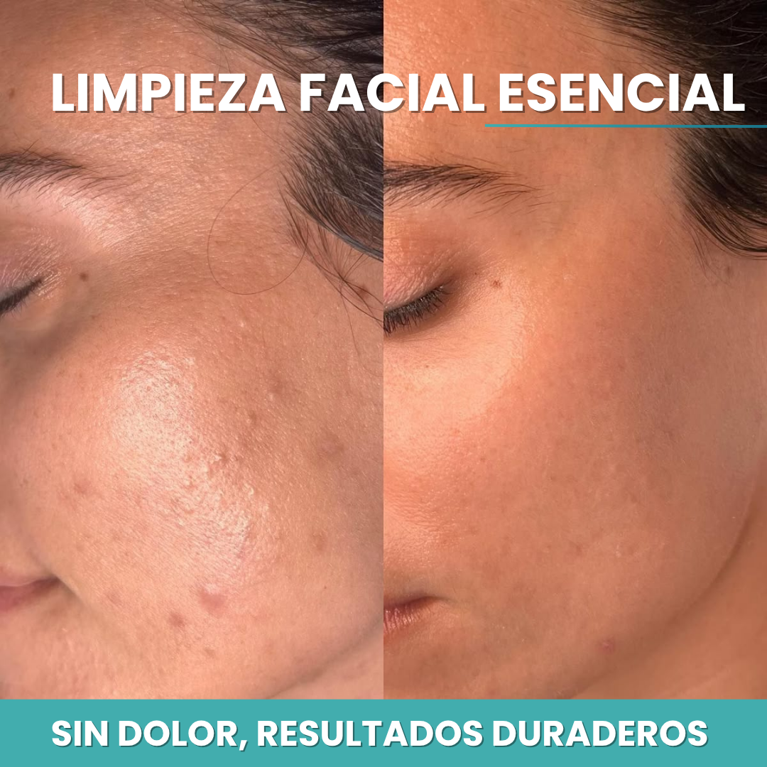 limpieza facial basica
