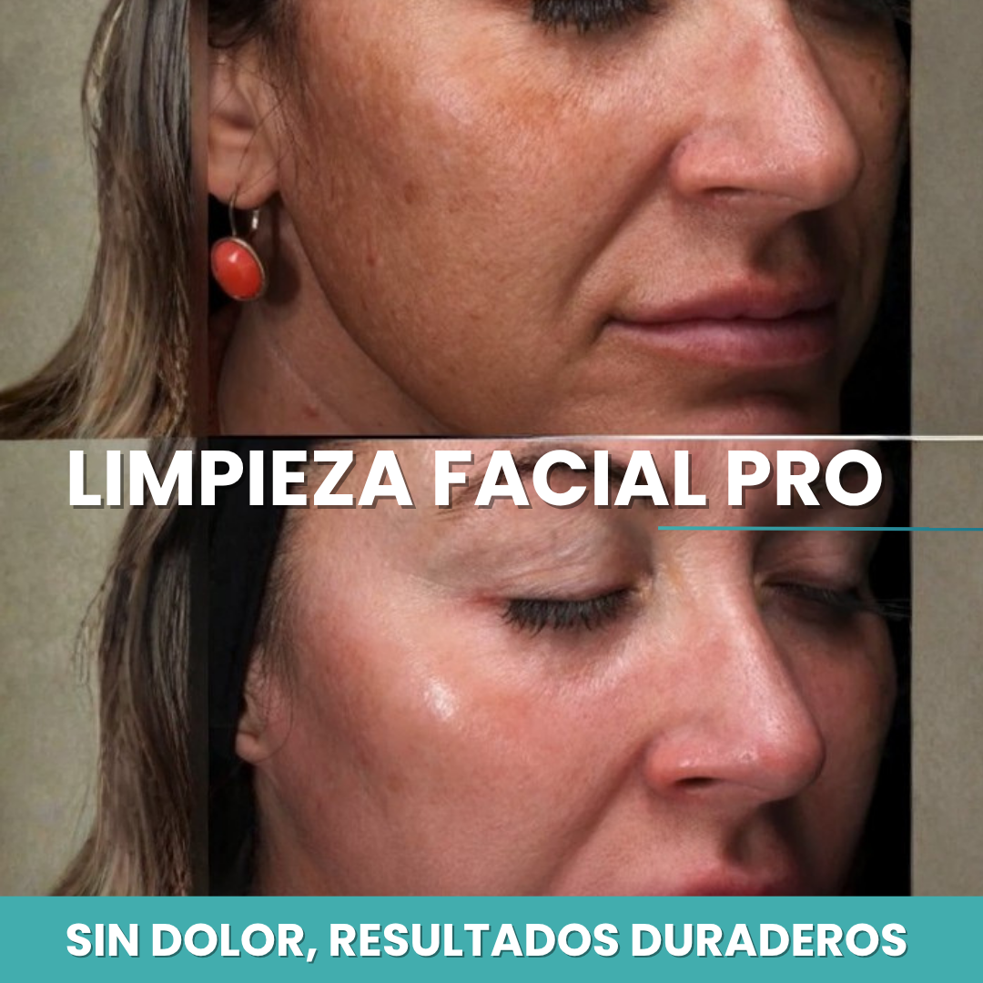 limpieza facial las condes